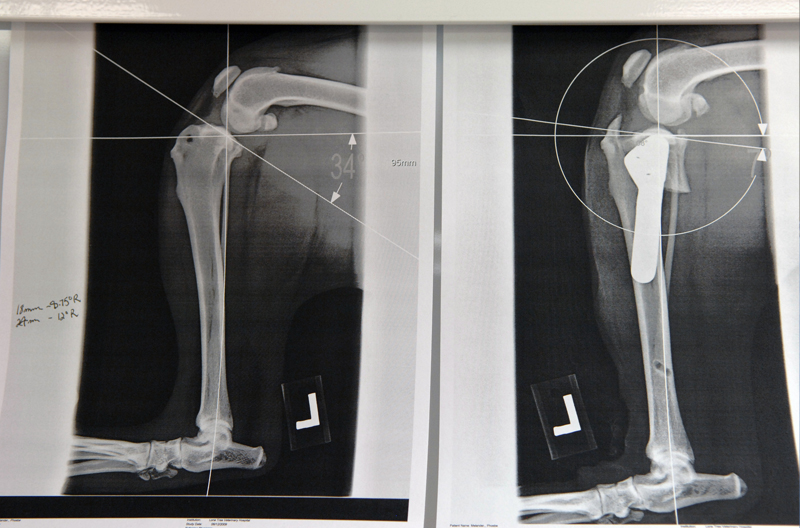 Before and after x-rays